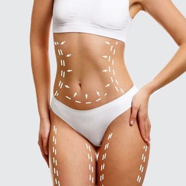 Annelik Estetiği Mommy Makeover Trabzon