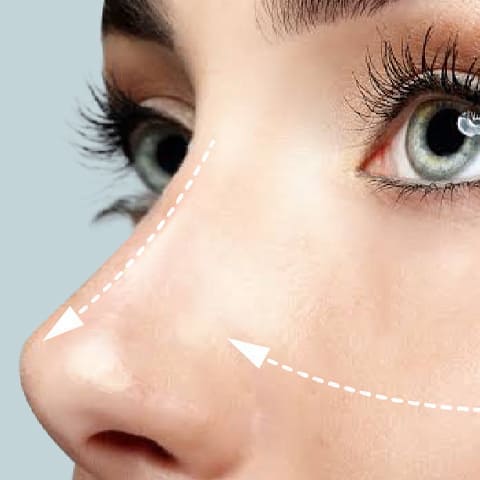 Umut Estetik Instagram