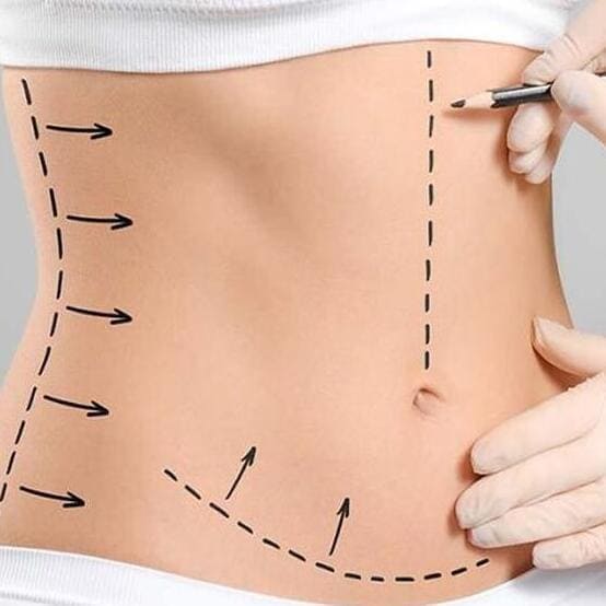 Umut Estetik Instagram