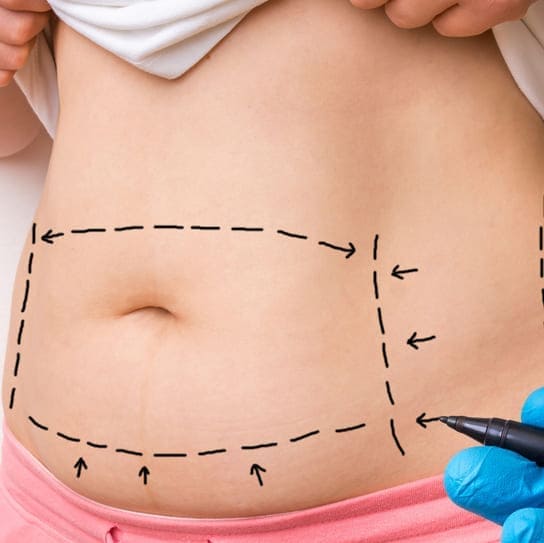 Umut Estetik Instagram