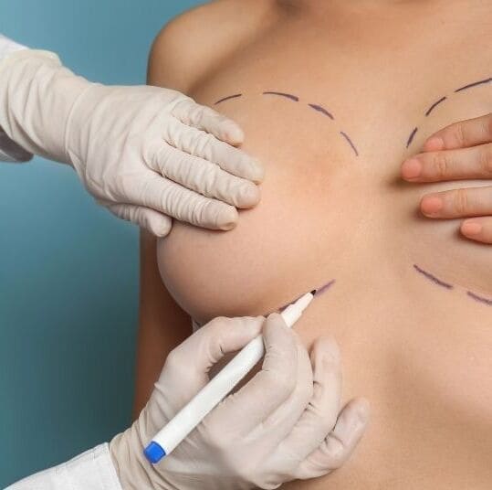 Umut Estetik Instagram